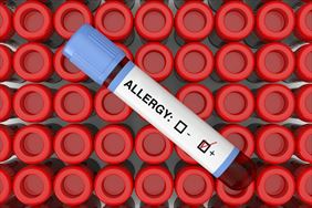 testy alergiczne, Zenon Siergiejko Prywatny gabinet internistyczno alergologiczny, Białystok
