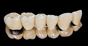 usługi protetyczne, Kulla Laboratorium Dentystyczne Anna Kulla, Stanisławie