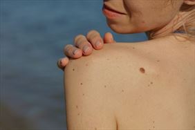 zabiegi medycyny estetycznej, Romuald Olszański, prof. dr hab. med. Gabinet medycyny estetycznej, dermatologii i alergologii, Gdynia