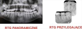 rtg zębów, Max-Dent Ortodoncja & Stomatologia - S.C. Ewa Maksym Arkadiusz Maksym, Czechowice-Dziedzice