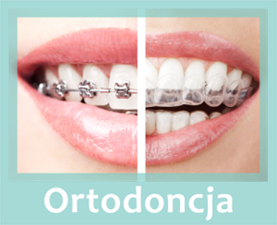 ortodoncja, Max-Dent Ortodoncja & Stomatologia - S.C. Ewa Maksym Arkadiusz Maksym, Czechowice-Dziedzice