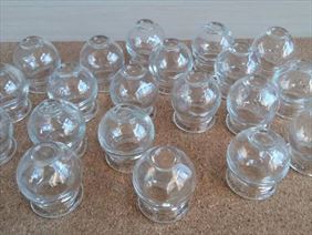 bańki ogniowe, Vitalmedic, Łódź