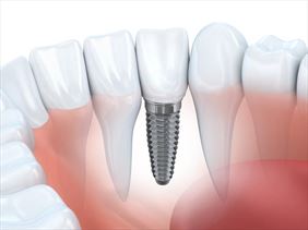 Es-Dent Gabinet Stomatologiczny opieka stomatologiczna, Es-Dent Gabinet Stomatologiczny Jarosław Nowak, Rzeszów