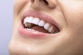 wybielanie zębów, NZOZ Primadental Specjalistyczna praktyka dentystyczna Michał Iwanek, Lublin