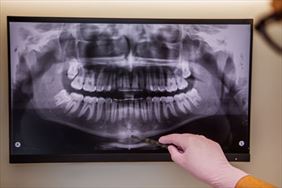 rtg zębów, Stomatolog Ewa Gielniewska-Ciborowska, Warszawa