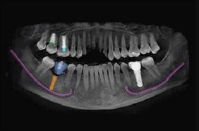 protetyka, Kinga Barbarzak Prywatny gabinet stomatologiczny, Opole
