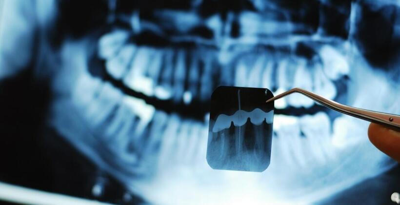 Pantomogram czy tomografia 3D — jak dobiera się badanie obrazowe przed zabiegiem chirurgii stomatologicznej
