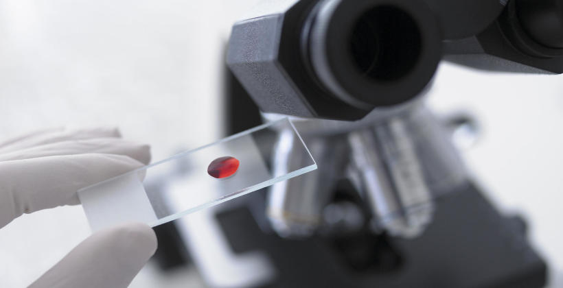Jakie badania laboratoryjne trzeba wykonywać regularnie? Jakie badania laboratoryjne trzeba wykonywać regularnie?