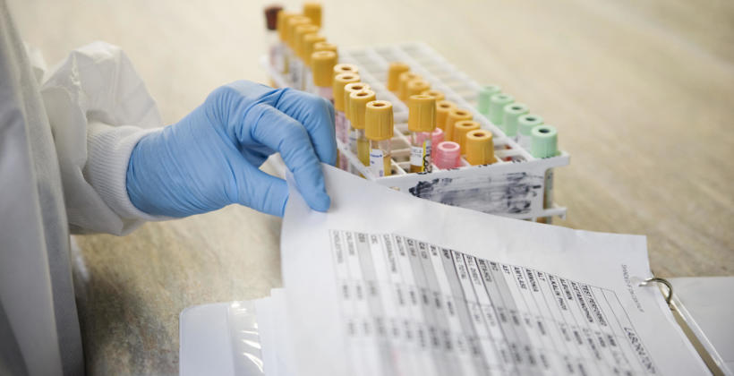 Badania laboratoryjne konieczne w I trymestrze ciąży Badania laboratoryjne konieczne w I trymestrze ciąży