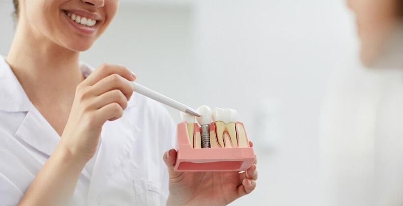Główne zalety implantów stomatologicznych Główne zalety implantów stomatologicznych