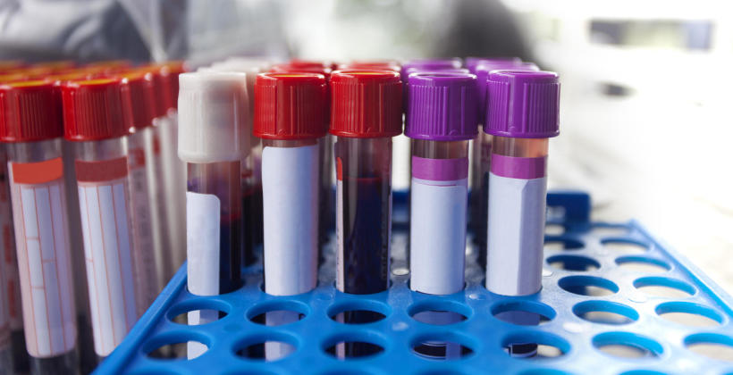 Kiedy wykonuje się badania serologiczne? Kiedy wykonuje się badania serologiczne?