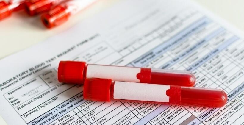 Badania sanepidowskie dla zdrowia publicznego