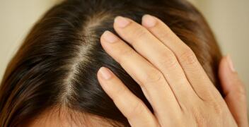 Mikropigmentacja skóry głowy – nowoczesne rozwiązanie