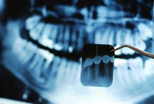 Pantomogram czy tomografia 3D — jak dobiera się badanie obrazowe przed zabiegiem chirurgii stomatologicznej
