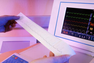 EKG jako jedno z badań medycyny pracy w przychodni Medan w Jarocinie 