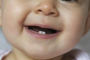 Gabinet Stomatologiczny Jardent: Zapobieganie próchnicy u dzieci - klucz do zdrowych zębów od najmłodszych lat