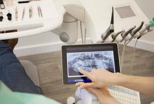 Korzyści z zastosowania cyfrowego RVG w stomatologii